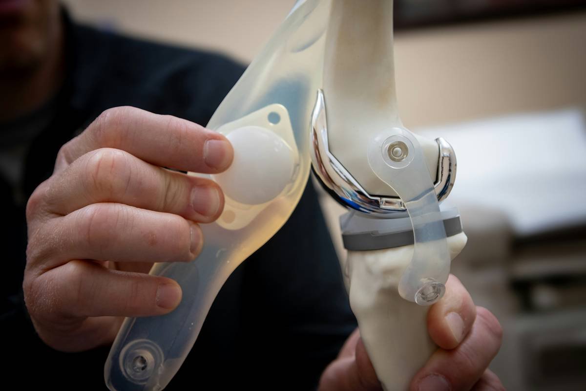 Close-up of realistic scar created using latex prosthetics