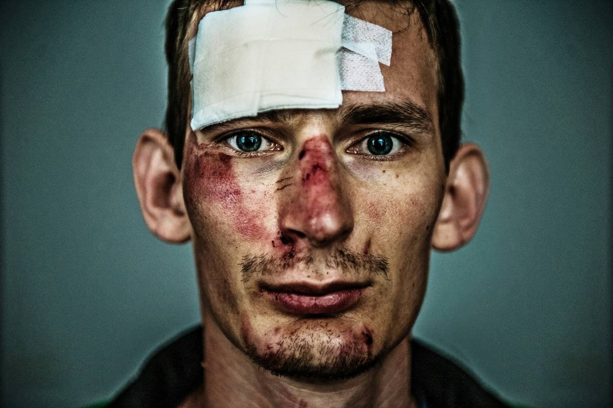 Wound Makeup Effects: The Prosthetic Artist’s Guide to Realistic, Safe & Stunning Trauma Looks